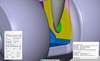  – Per la finitura di una protesi di ginocchio speciale stampata in 3D da un impianto di cromo cobalto o titanio, il reparto prototipizzazione di Aesculap ricorre, tra l’altro, alla “Finitura tangenziale” del pacchetto <em>hyper</em>MILL<sup>®</sup> MAXX&nbsp;Machining con un utensile a barile conico. 